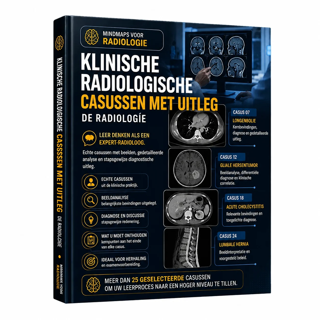 Radiologische casussen met uitleg